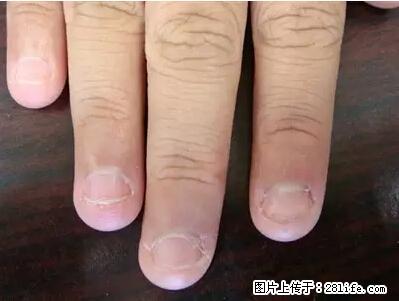 剪指甲、挖耳屎，这些日常小动作竟隐藏大危害！ - 滁州生活资讯 - 滁州28生活网 chuzhou.28life.net